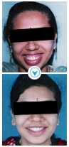 Facial Reconstruction India