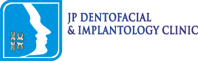Dental Implants Kerala