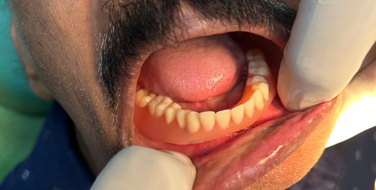 Jaw Correction Surgery