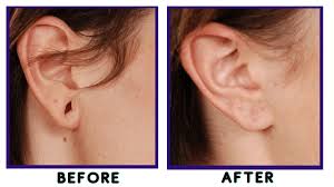 Ear Construction
