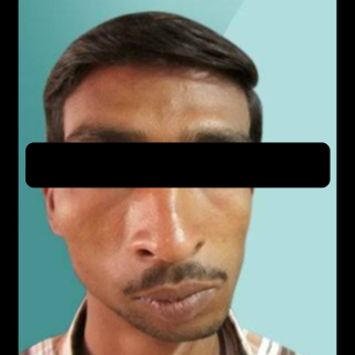 Orthognathic Surgery