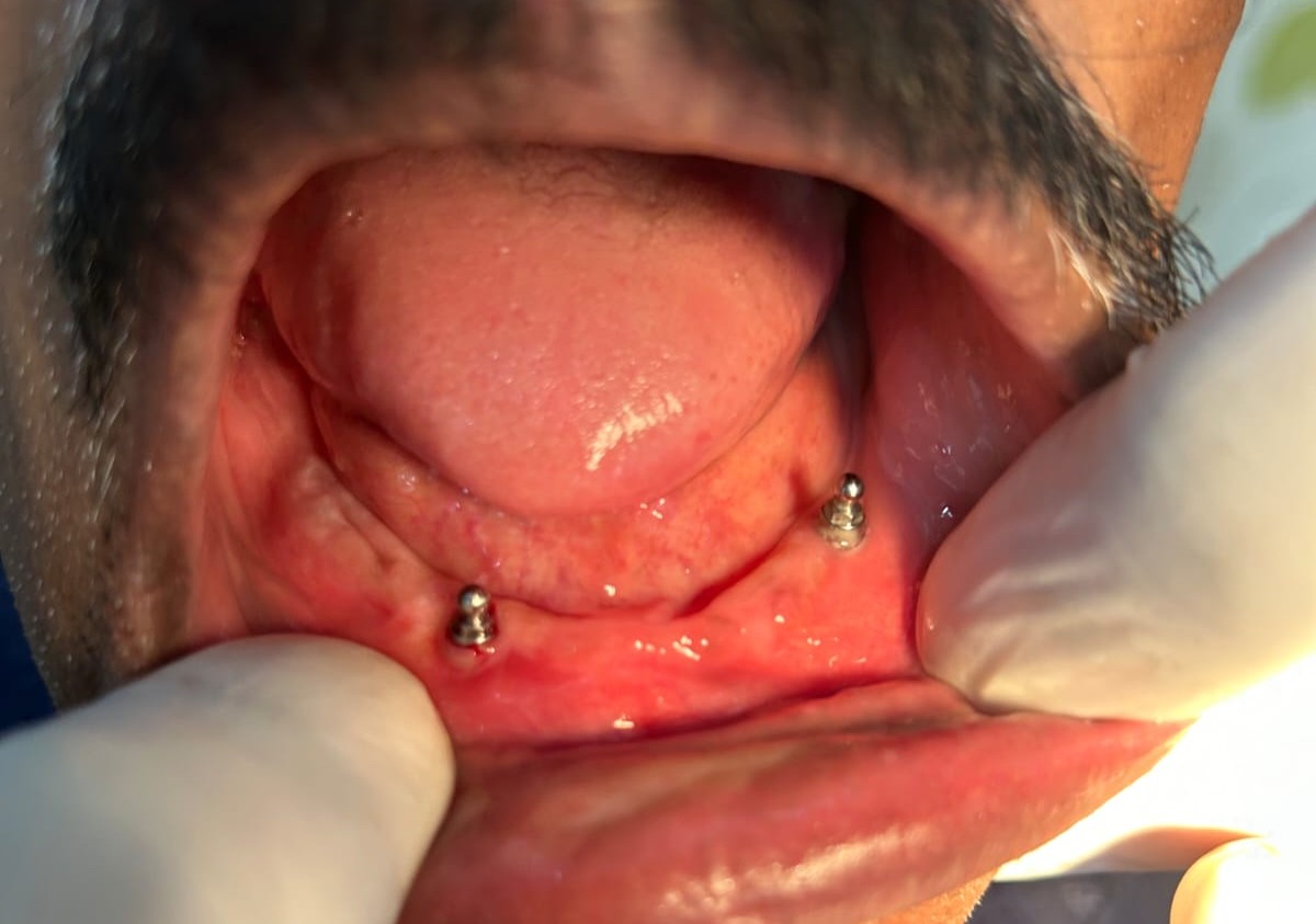 Prosthodontics