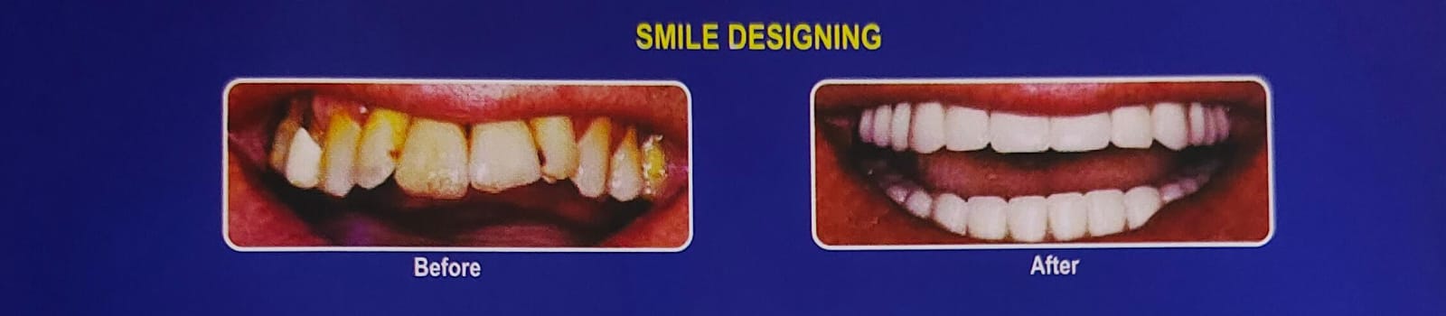 Cosmetic Dentistry