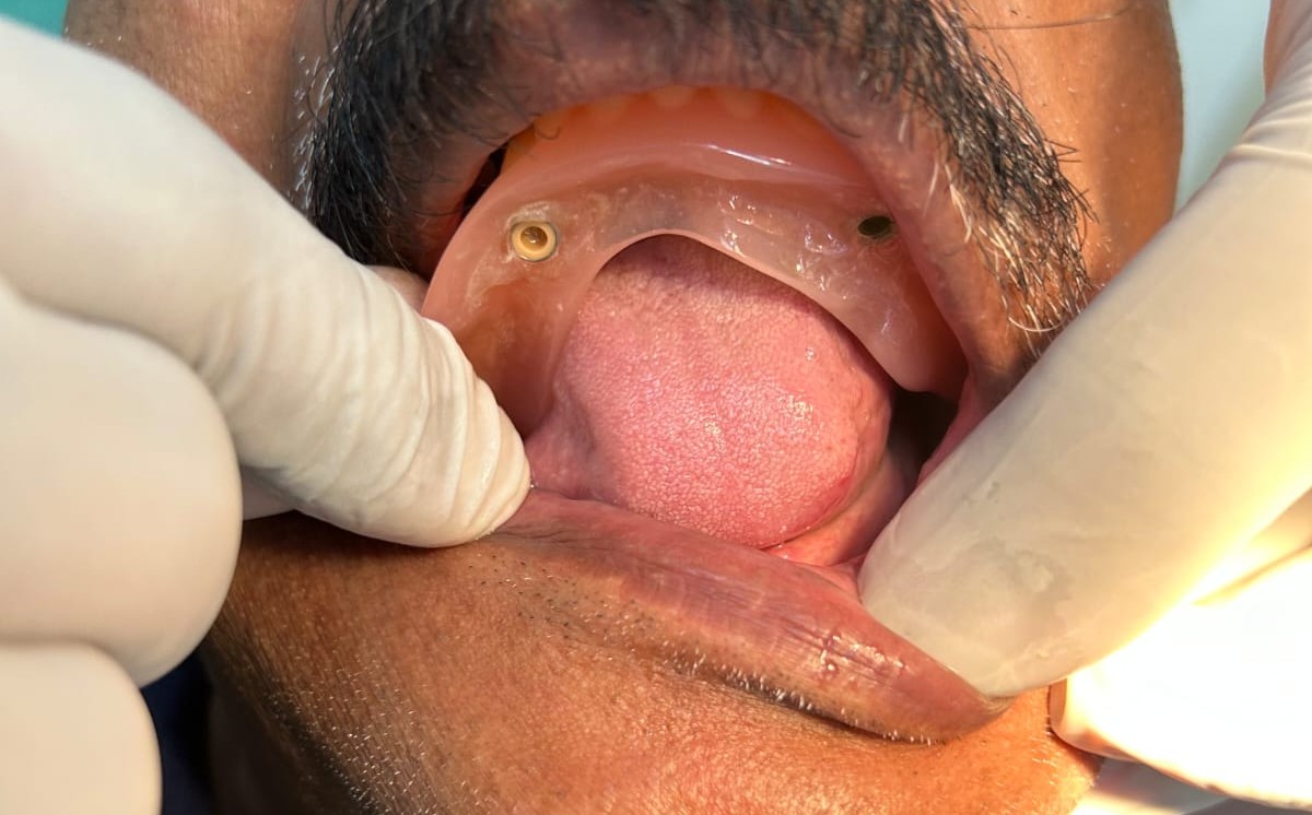 Prosthodontics
