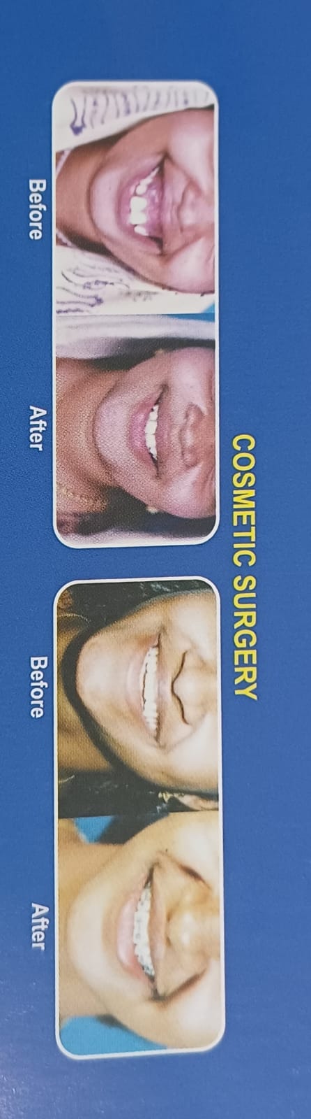 Facial Plastic Surgery