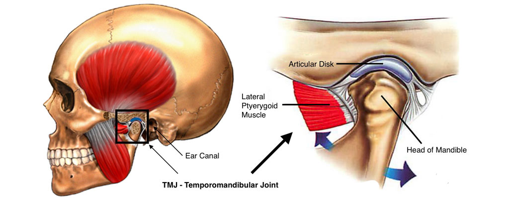 TMJ Surgeries