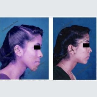 Facial Plastic Surgery