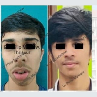 Facial Plastic Surgery