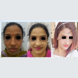 Facial Plastic Surgery
